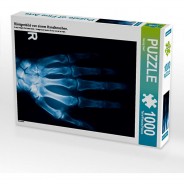 Preisvergleich für Puzzle: Puzzle CALVENDO Puzzle Röntgenbild von einem Handknochen. - 1000 Teile Foto-Puzzle glückliche Stunden  Kinder